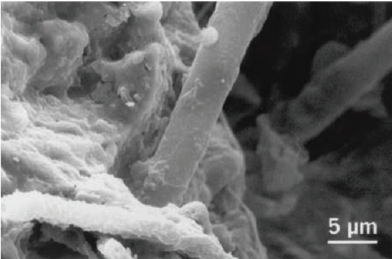 2 hyphes fongiques d'environ 20 microm&egrave;tres