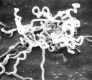 Photographie de T. Pallidum une bact&eacute;rie Spiroch&egrave;te, clich&eacute; du CDC (Id&nbsp;: # 1971)