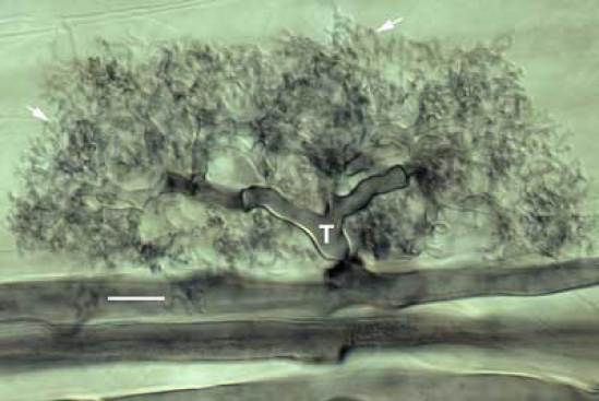 Photo d'arbuscule de Glomus développé dans une cellule racinaire -Brundrett MC. 2008. Mycorrhizal Associations: The Web Resource. http://mycorrhizas.info/vam.htm
