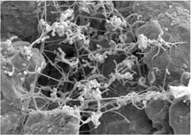 Réseau de fil avec avec des petites boules (bactéries) dans le sol vu au microscope électronique